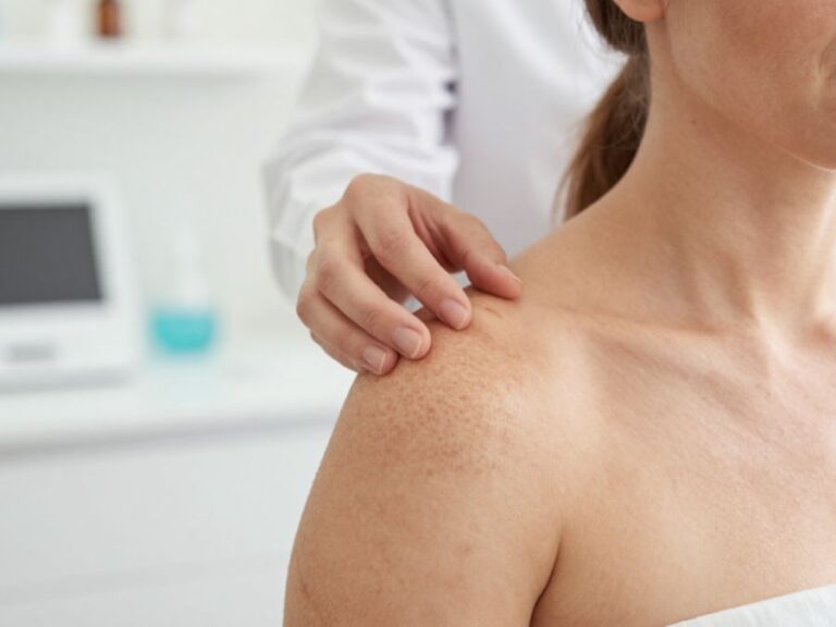 Essential Guide To Sun Damage Repair On Hilton Head Island