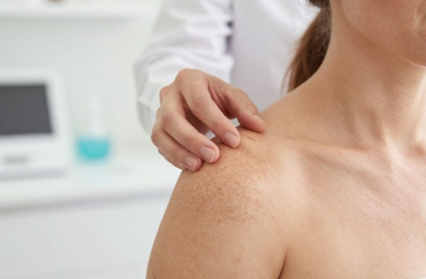 Essential Guide To Sun Damage Repair On Hilton Head Island
