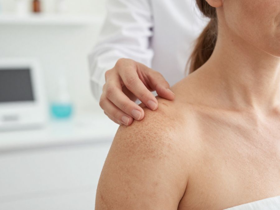 Essential Guide To Sun Damage Repair On Hilton Head Island